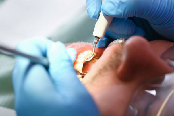 Best Dentist for Dental Trauma  in Perry, OH