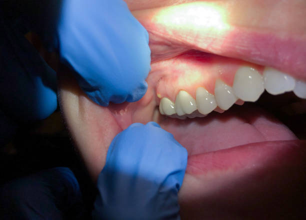 Best Urgent Tooth Repair  in Perry, OH