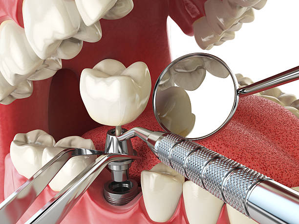 Best Emergency Gum Pain Relief  in Perry, OH